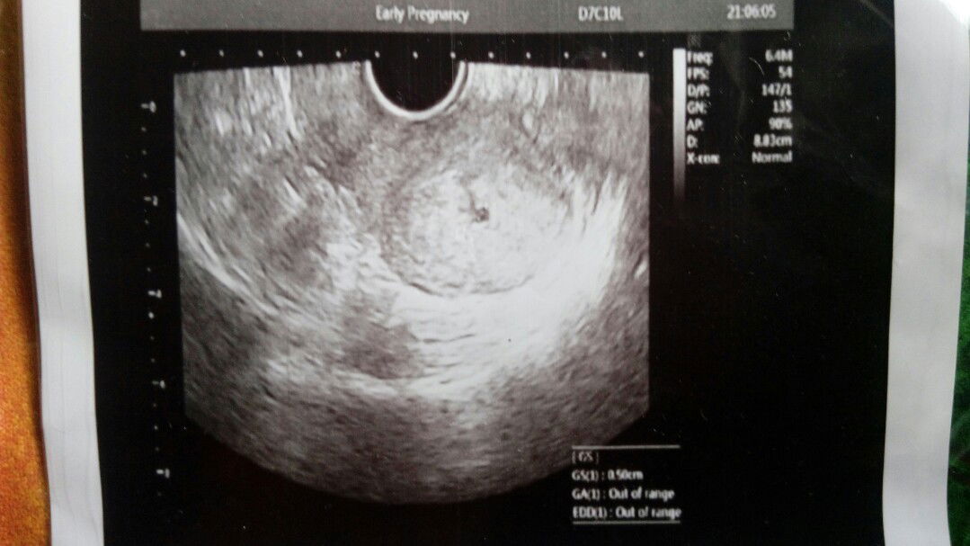 kata dokter ukuranya kecil, wajarkah?