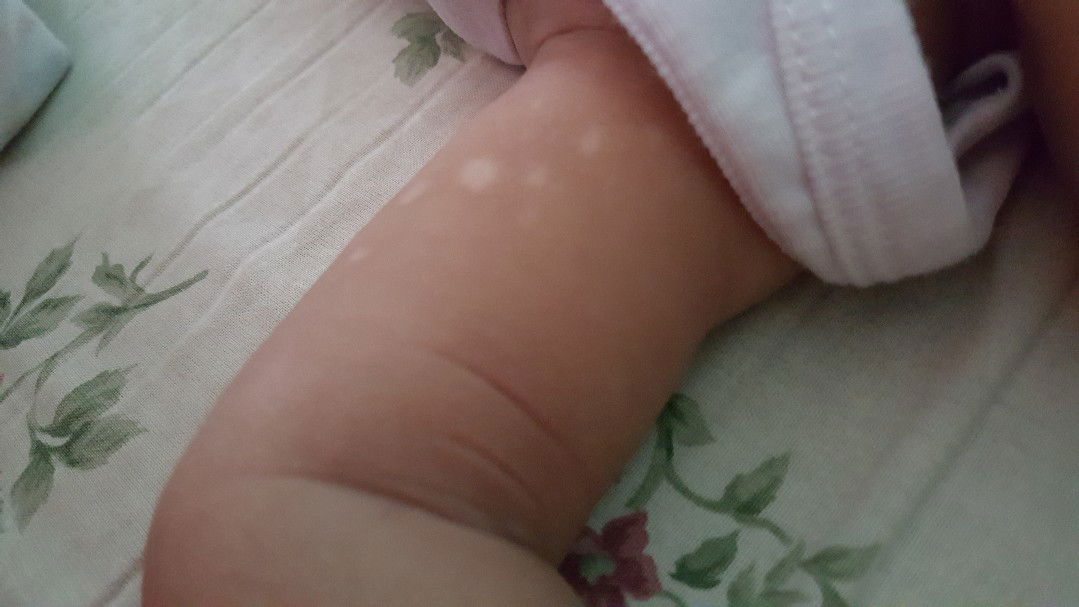 bekas biang keringat