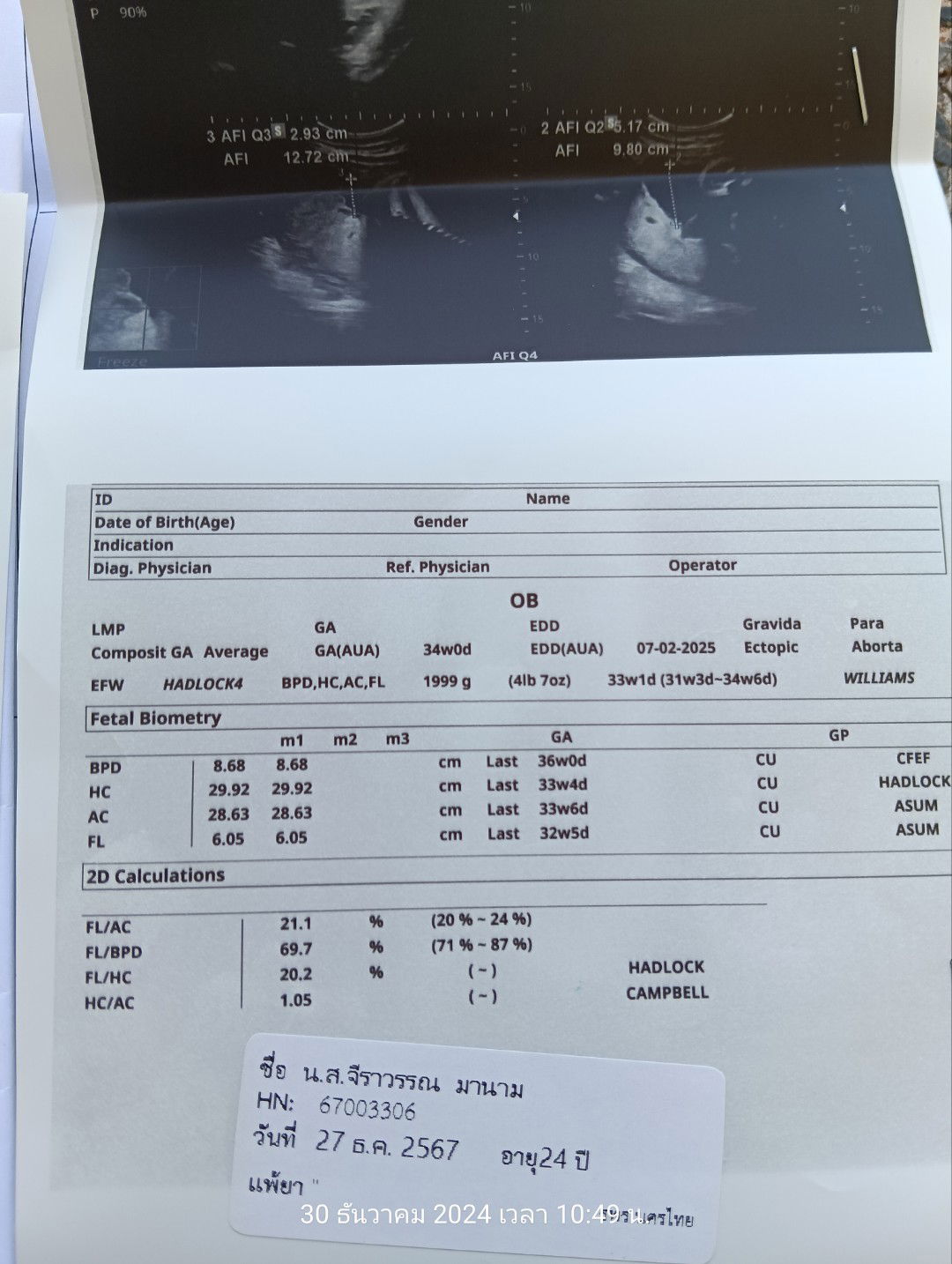 มีข้อสงสัยค่ะขอสอบถามแม่ๆหน่อย