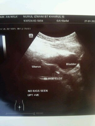 Risau dan Mengharap.