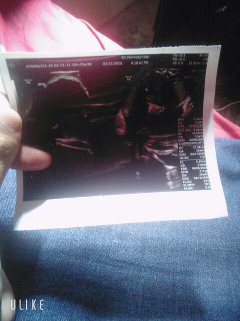 makanan apa ya bund untuk nambah berat badan debay?