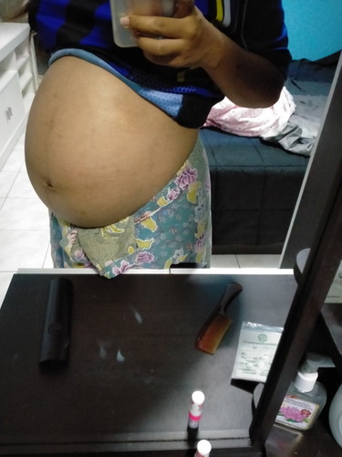 36+2 w ยังไม่รู้หญิงหรือชาย
