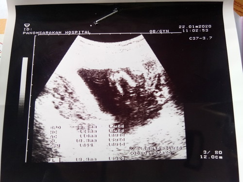 หญิงหรือชายครับ