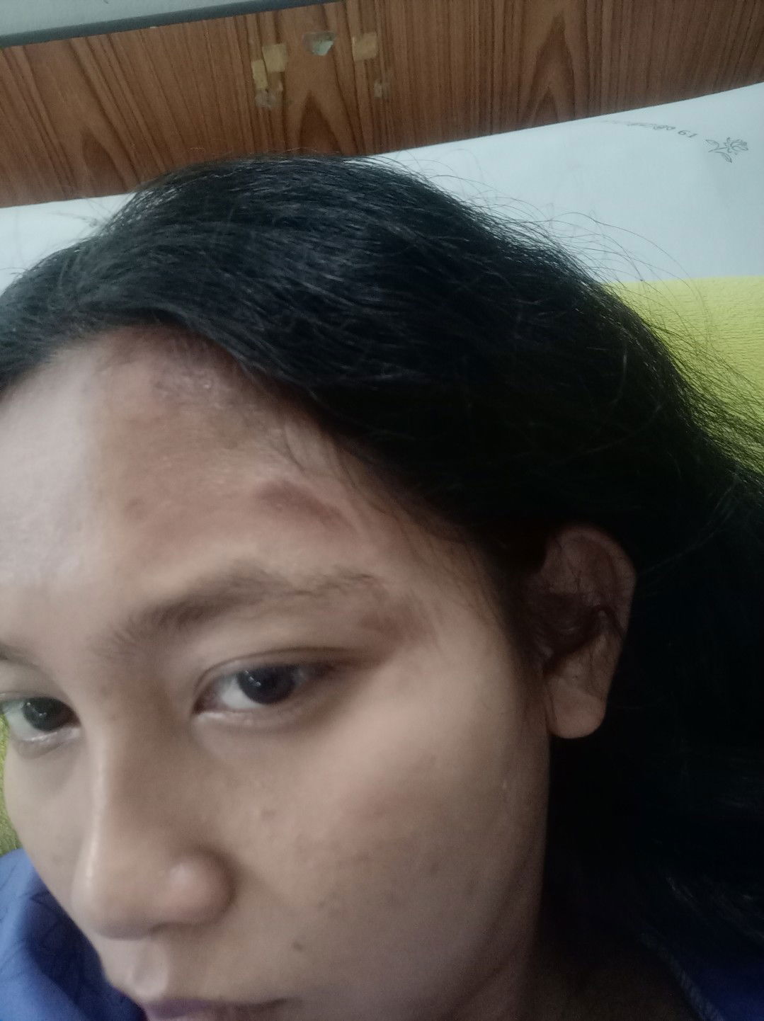 แม่ๆท่านไหนเคยเป็นลมวูบไปตอนท้องไหมคะ