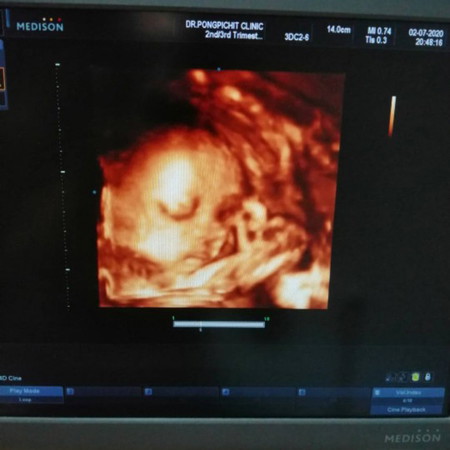 ตื่นเต้นทุกครั้งแต่ครั้งนี้...