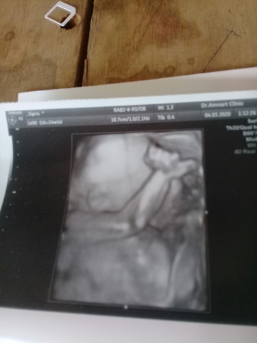 25 สัปดาห์ ปิดหน้าปิดตา ไม่ให้อิแม่เห็นเลย