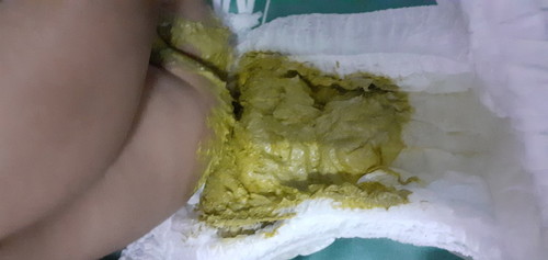 สีอึ๊ผิดปกติมั้ยคะะ