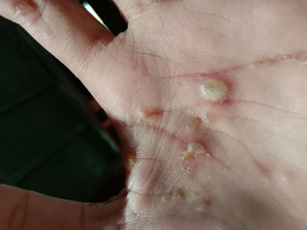 ada yg pernah ngalamin ???