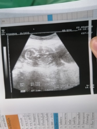 13w6b