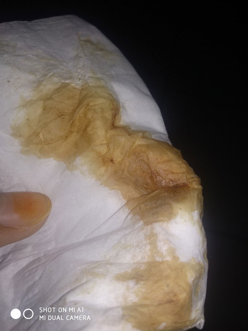 keluar kecoklatan saat hamil 6 minggu