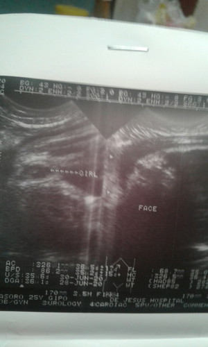 ultrasound