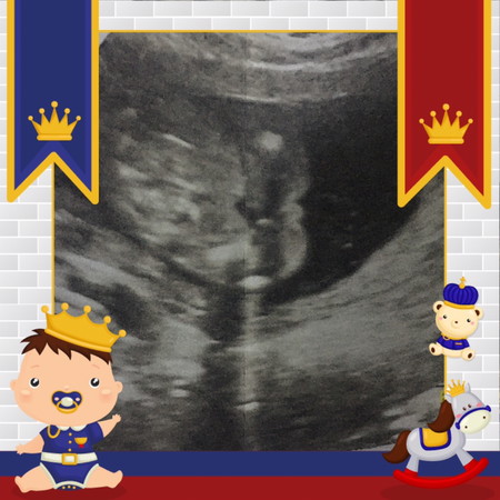 เพศไหนกันแน่