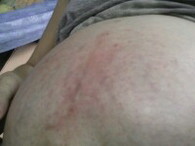 ตั้งครรภ์