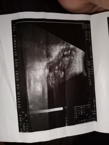 ultrasound