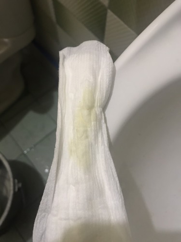 Help green discharge ba to mga sis?