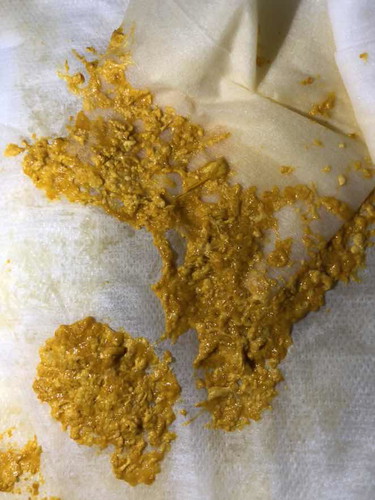 ขอนุญาตครับ