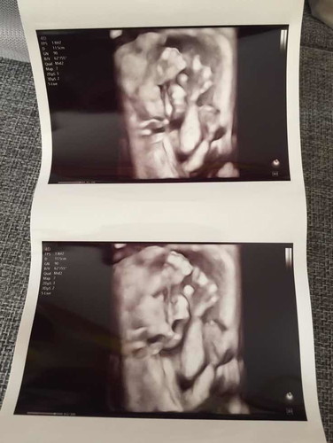 20w 5D