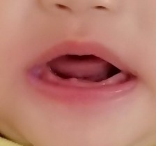 teething?