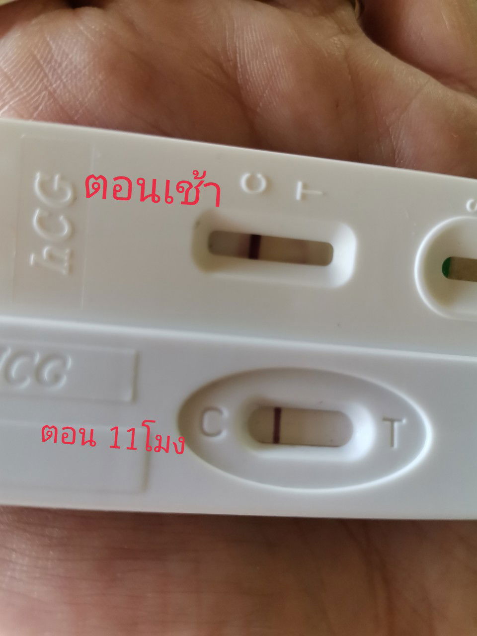 เล่าสู่กันฟัง