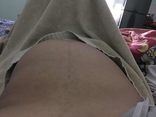 ใครเป็นบ้างค่ะ