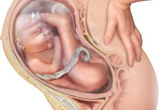 usia 33 week janin sungsang