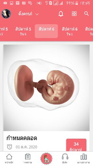 แพ้ท้อง