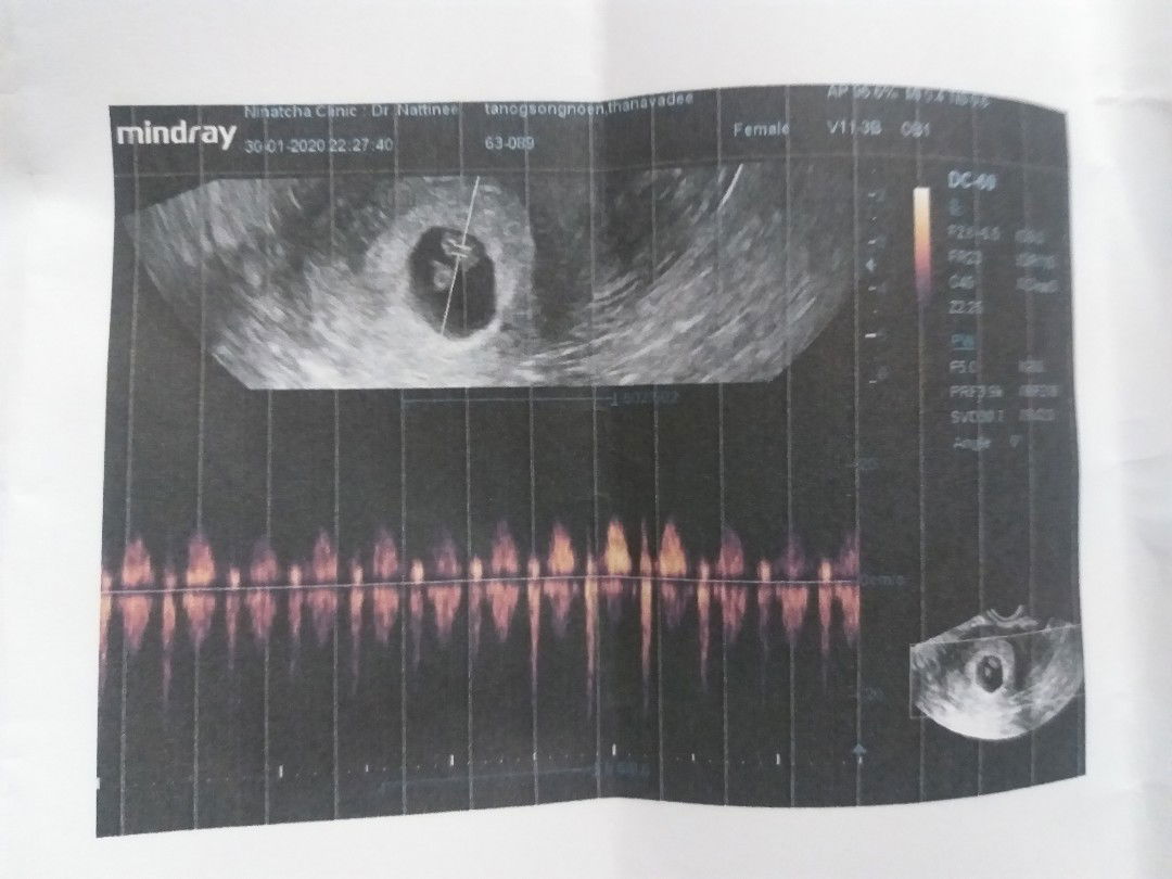 Tanavadee:) profile icon