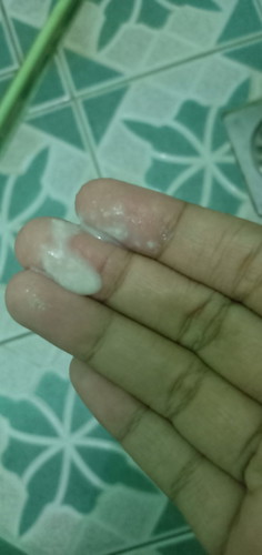 white discharge