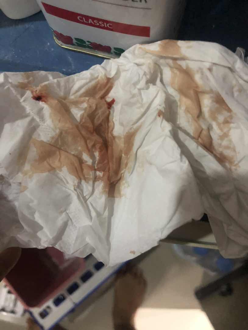 เมื่อคืนมีเลือดออกจากช่องคลอด