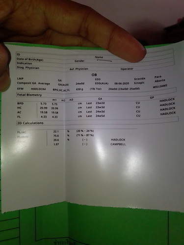 ซาวแล้วได้ใบนี้มา