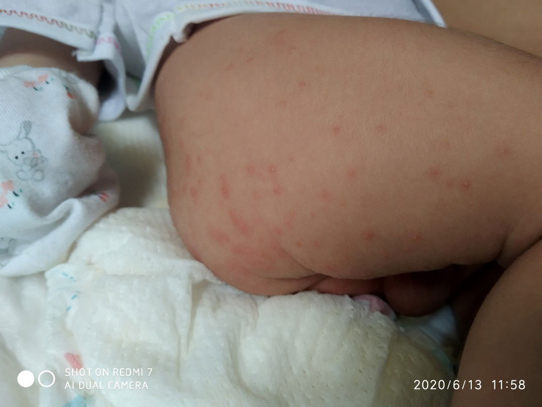 Xin ý kiến các mom