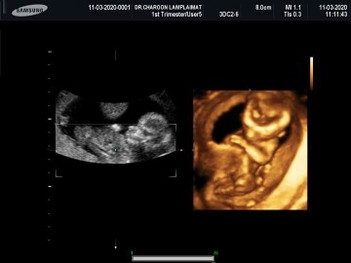 14w??