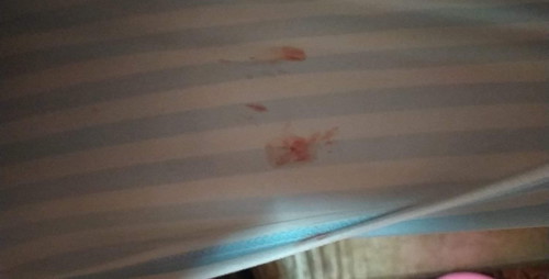 แบบนี้คือจะคลอดแล้วใช่มั้ยค่าตื่นเต้น