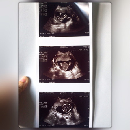 เบบี๋ของแม่