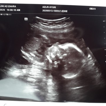 first babyy