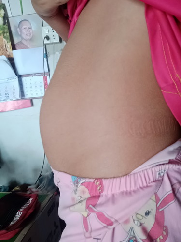 ท้องแข็งบ่อย ปวดฉี่บ่อยมากก เป็นอะไรไหม?