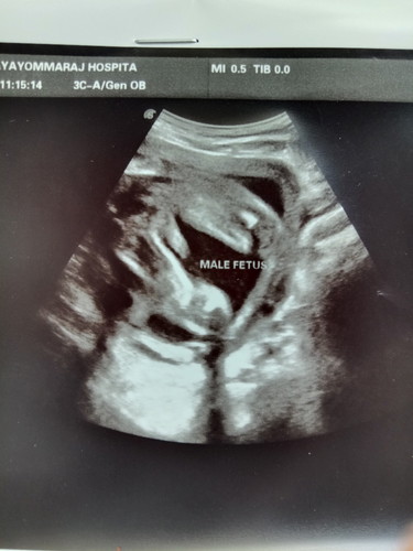 ผลซาวด์