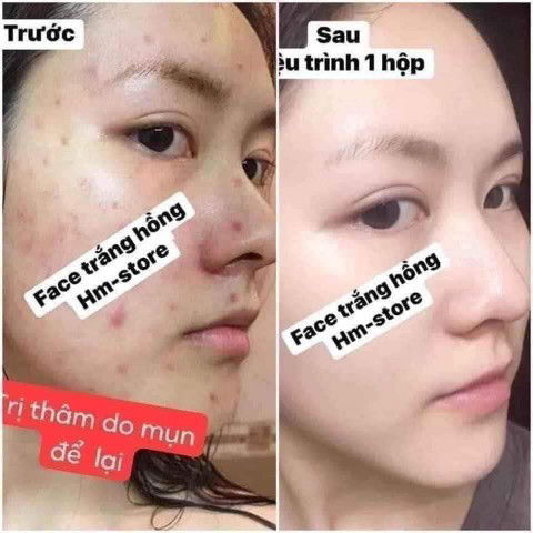 tình trạng da mẹ bầu