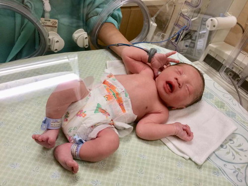 คลอดแล้วจ้าา คลอดก่อนกำหนด 38 W พอดี น้องนิวตั้นครับ