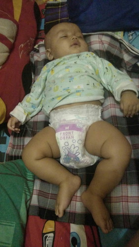 imunisasi