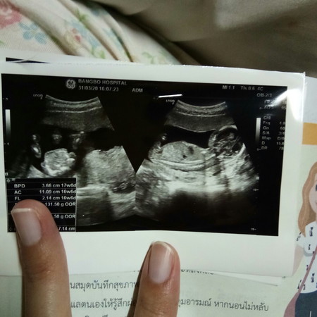 ซาวดูเพศ