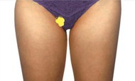 a lump/cyst near my vagina/inner thigh