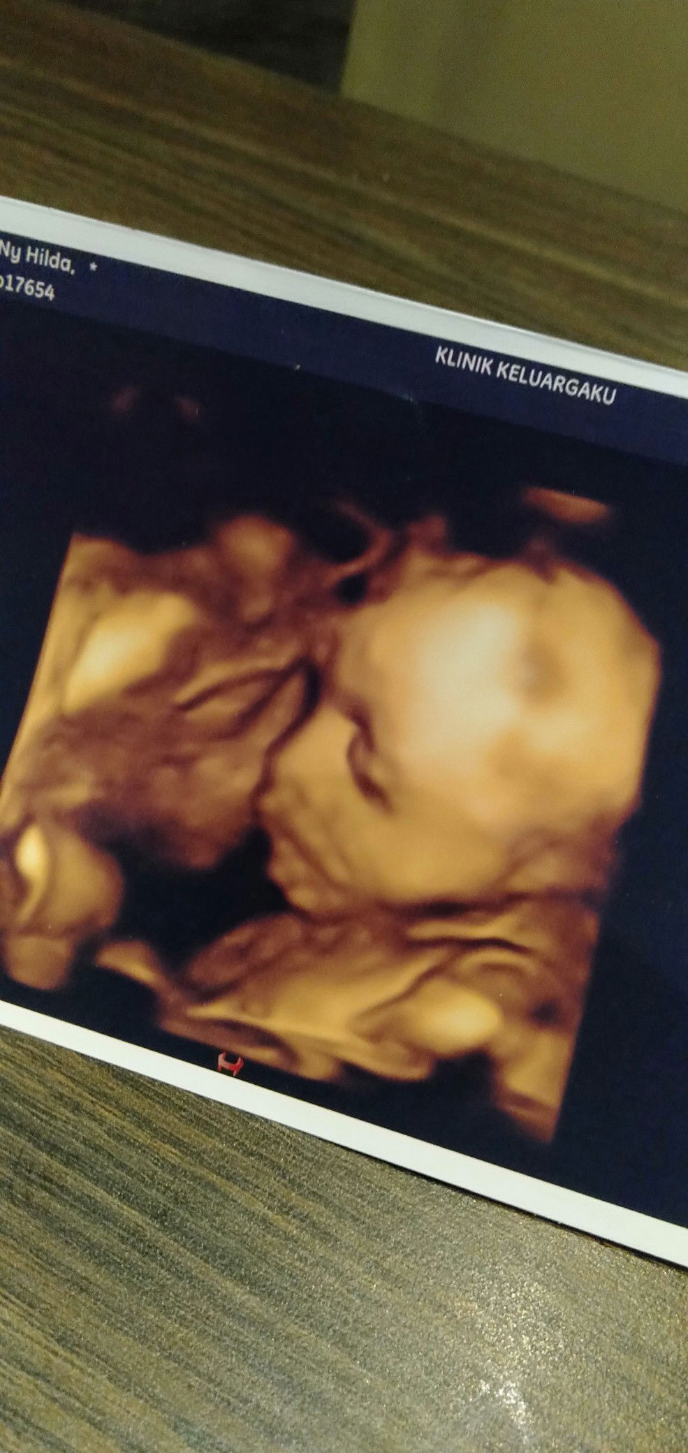 Hilda Pertiwi profile icon