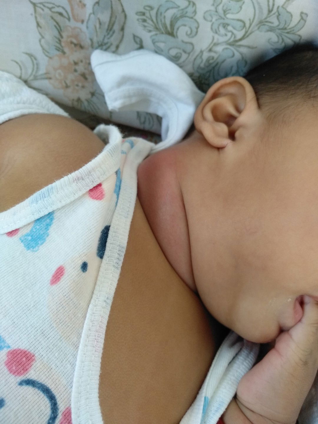 may nakakabahalang kulani ang baby ko