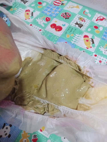 baby's poop