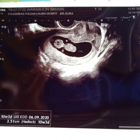 ขอบคุณของขวัญที่พิเศษ คุณแม่ลูก1