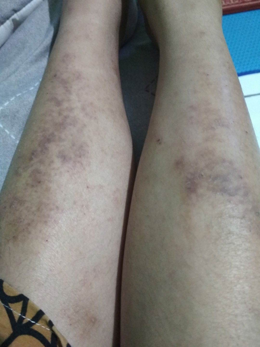 Ini bakalan hilang gak ya?