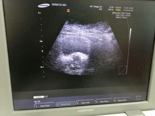first baby