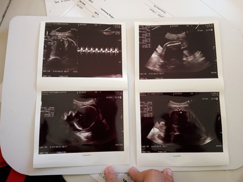 แอบดูเด็กน้อย