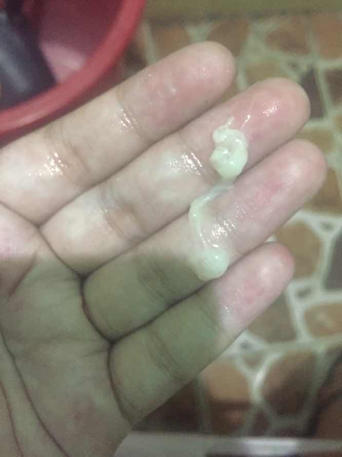 Discharge or mucus plug